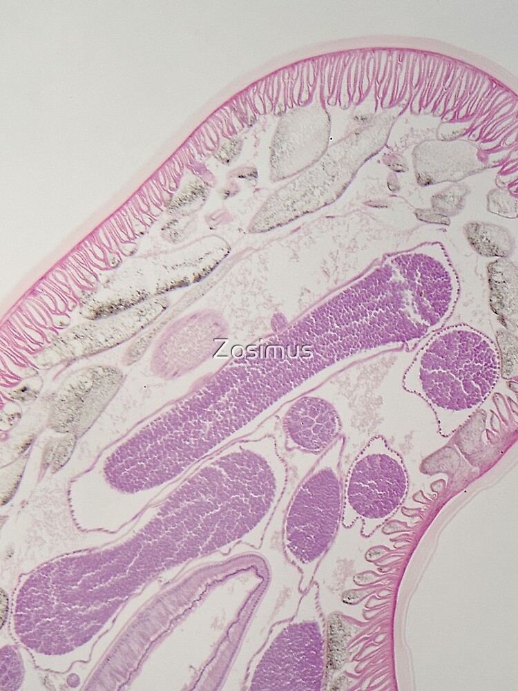 Parasitic nematode worm (Ascaris sp.) under the microscope by Zosimus