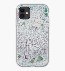 Cotton leaf under the microscope iPhone Case