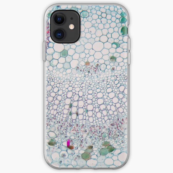 Cotton leaf under the microscope iPhone Soft Case