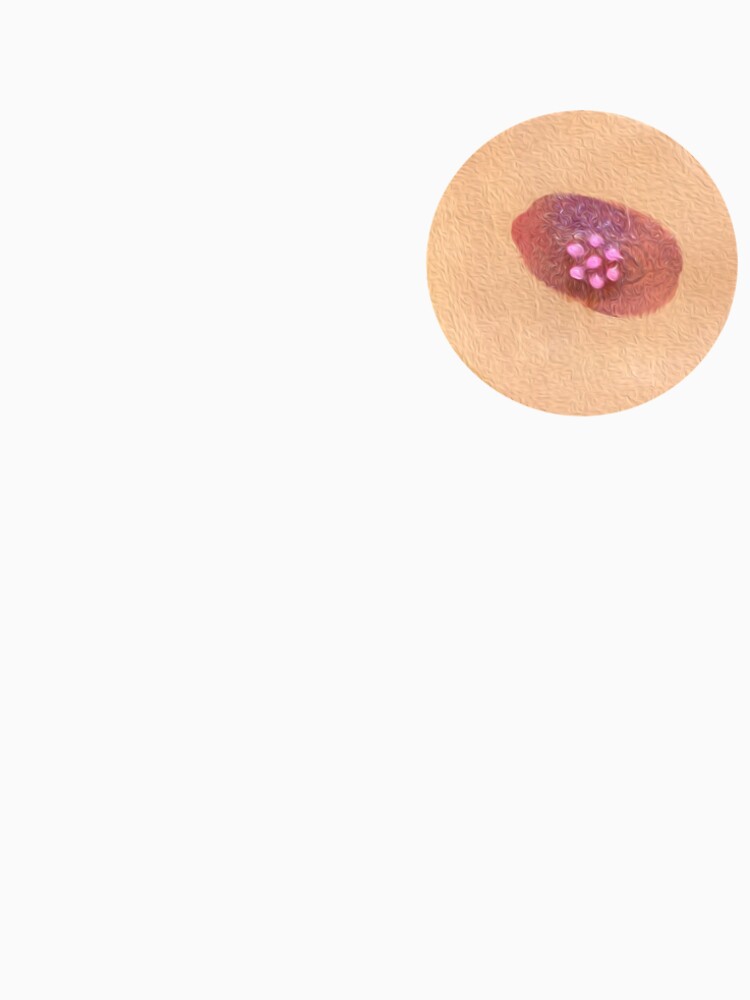 First Edition Nipple- Lacey by friendlynipple