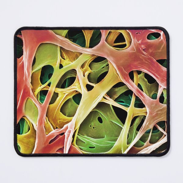 Item preview, Microscope Photo of  Mushroom Mycelium, SEM designed and sold by ScienceSource.
