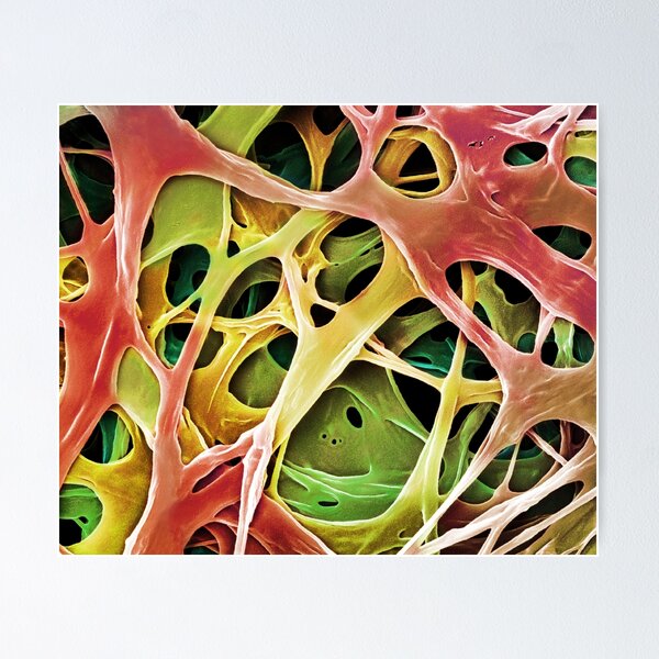 Item preview, Microscope Photo of  Mushroom Mycelium, SEM designed and sold by ScienceSource.