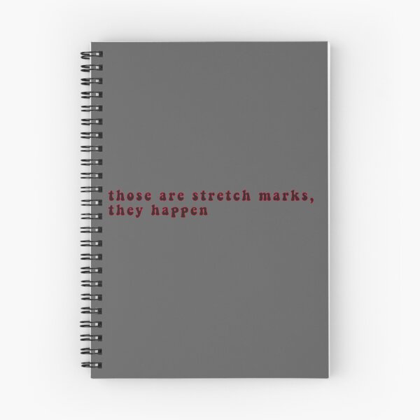 Item preview, Stretch Marks designed and sold by TheDayisOurs.
