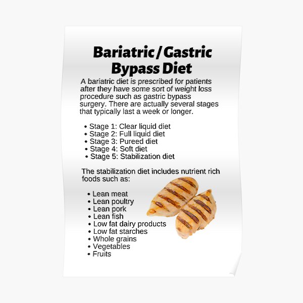 "Bariatric / Gastric Bypass Diet Infographic" Poster for Sale by