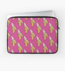 Pink U - Banana (Open) Laptop Sleeve