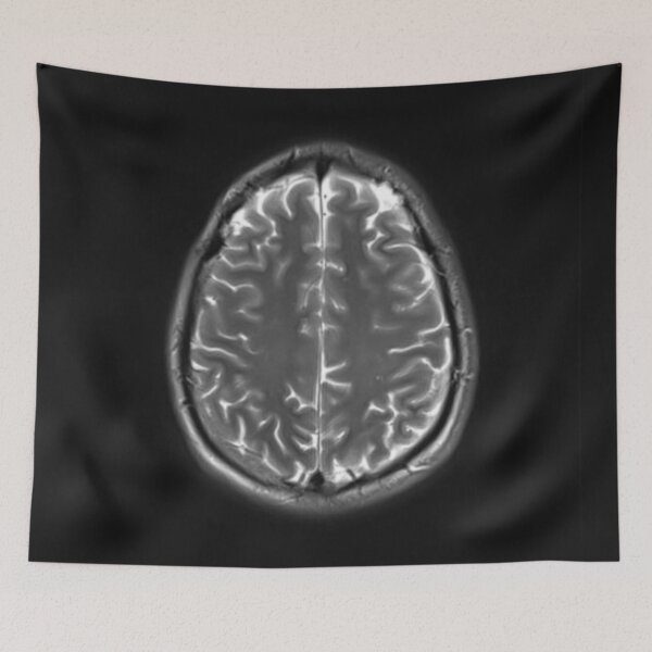 Item preview, The artist's brain scan designed and sold by The Iconic Minimalist.