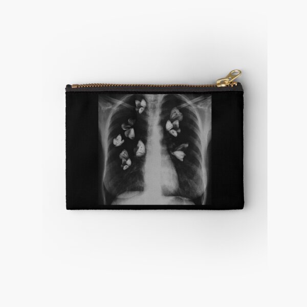 Item preview, x ray with butterflies in stomach designed and sold by BrontesWhimsyStore.