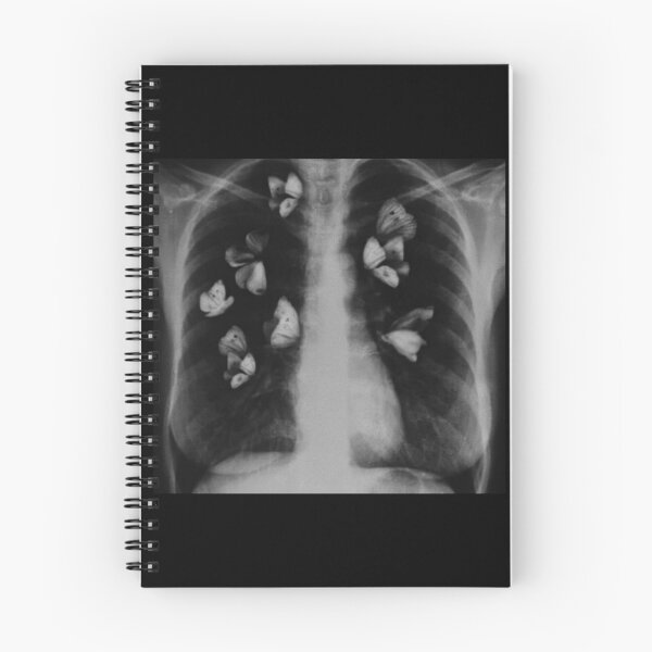 Item preview, x ray with butterflies in stomach designed and sold by BrontesWhimsyStore.