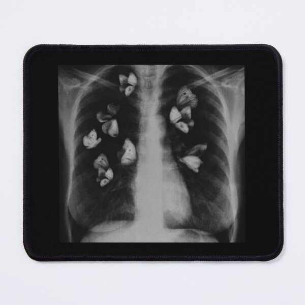 Item preview, x ray with butterflies in stomach designed and sold by BrontesWhimsyStore.