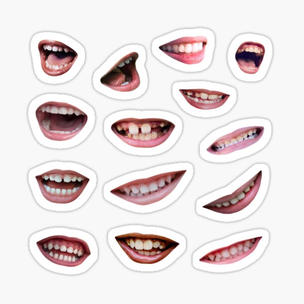 moldable mouth tray crooked teeth｜TikTok Search