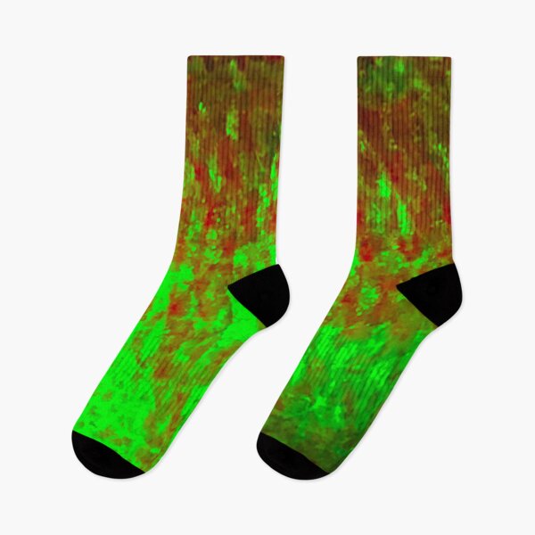 Item preview, Bright Green and Red Bergall Skin Pattern designed and sold by CJRPics.