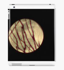 Moon Rise 010 iPad Case/Skin
