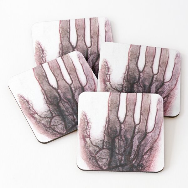 Item preview, X-ray of Blood Vessels in the Hand designed and sold by ScienceSource.