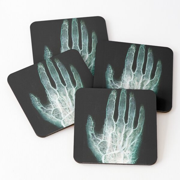 Item preview, f X-ray of Blood Vessels in the Hand designed and sold by ScienceSource.
