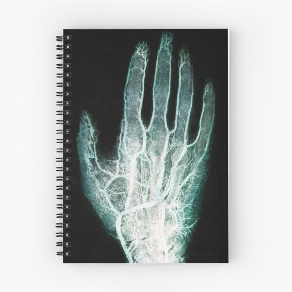 Item preview, f Radiografía de vasos sanguíneos en la mano designed and sold by ScienceSource.
