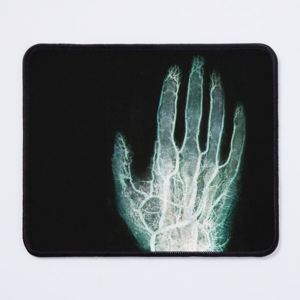 Item preview, f X-ray of Blood Vessels in the Hand designed and sold by ScienceSource.