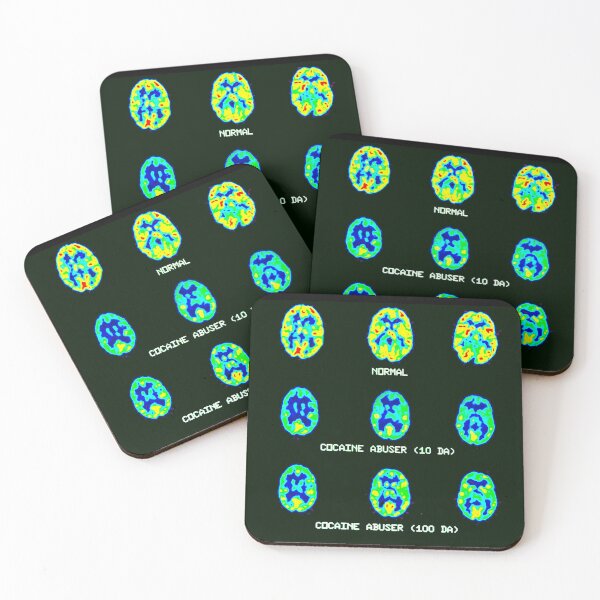 Item preview, Your Brain on Cocaine, Medical Brain Scan designed and sold by ScienceSource.