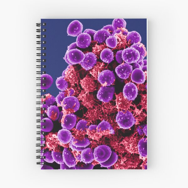 Item preview, Staphylococcus Epidermidis Bacteria, SEM designed and sold by ScienceSource.
