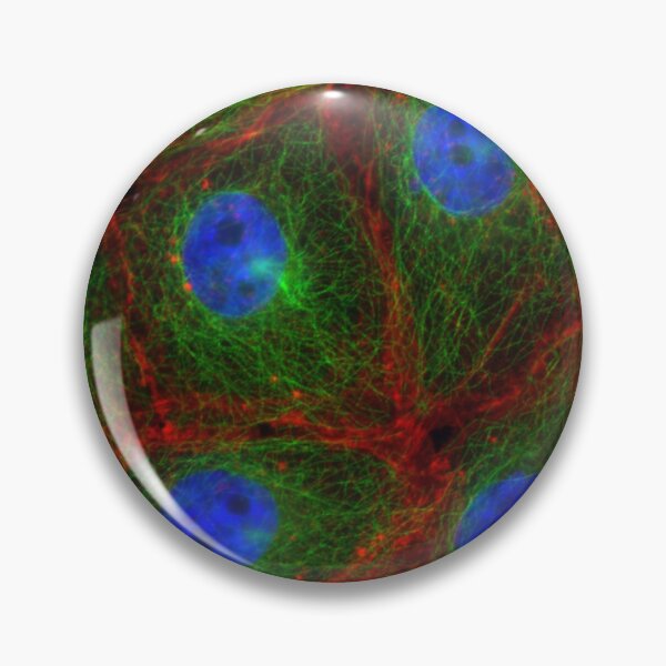 Item preview, Breast Cancer Cells, FM, Microscope designed and sold by ScienceSource.