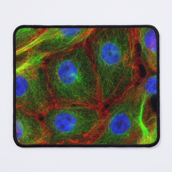 Item preview, Breast Cancer Cells, FM, Microscope designed and sold by ScienceSource.