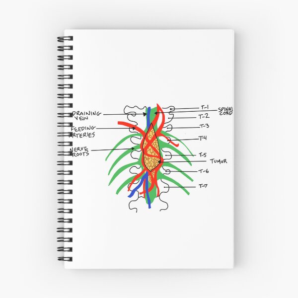 Item preview, Grey's Anatomy - tumor art designed and sold by baileyyfaith.