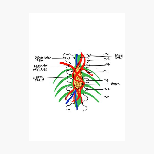 Aperçu de l'œuvre Grey's Anatomy - L'art des tumeurs créée et vendue par baileyyfaith.