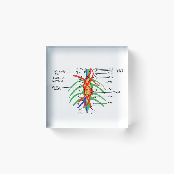 Item preview, Grey's Anatomy - tumor art designed and sold by baileyyfaith.