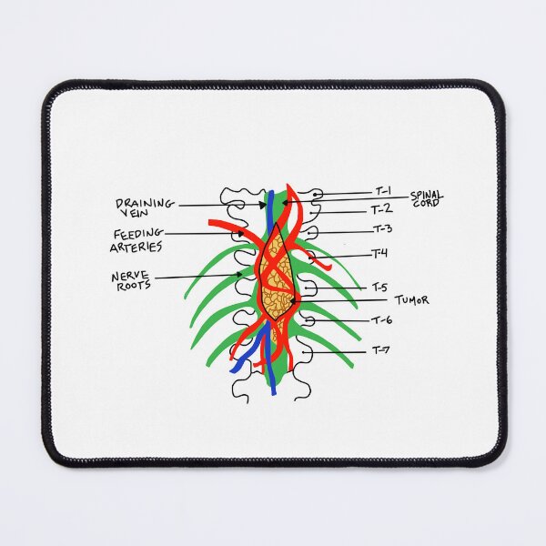 Item preview, Grey's Anatomy - tumor art designed and sold by baileyyfaith.