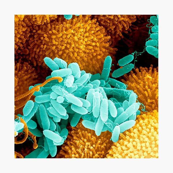 Item preview, Pseudomonas aeruginosa bacteria (B220/1027) designed and sold by SciencePhoto.