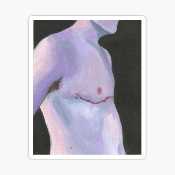Item preview, top surgery  designed and sold by theo cook.