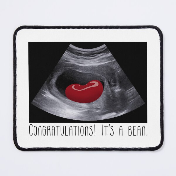 Item preview, It's a bean! designed and sold by Stinga Springa.