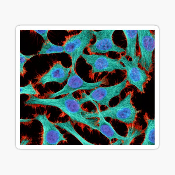 Item preview, HeLa cells, light micrograph (C009/7540) designed and sold by SciencePhoto.