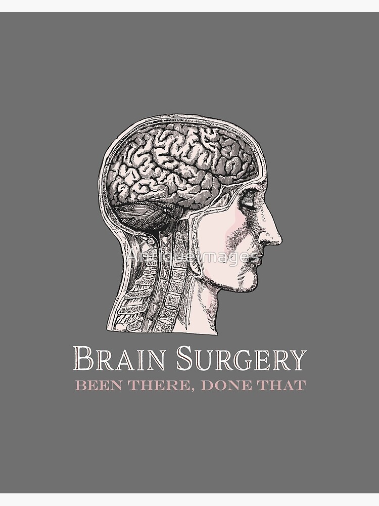 Brain Surgery Been There Done That.