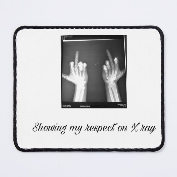 Item preview, x ray designed and sold by DesaretaLleshaj.