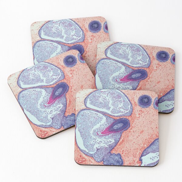 Item preview, Dermoid ovarian cyst, light micrograph (C019/9256) designed and sold by SciencePhoto.