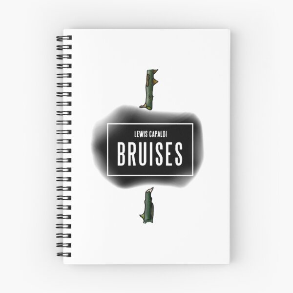 Item preview, Bruises Capaldi designed and sold by decua555.