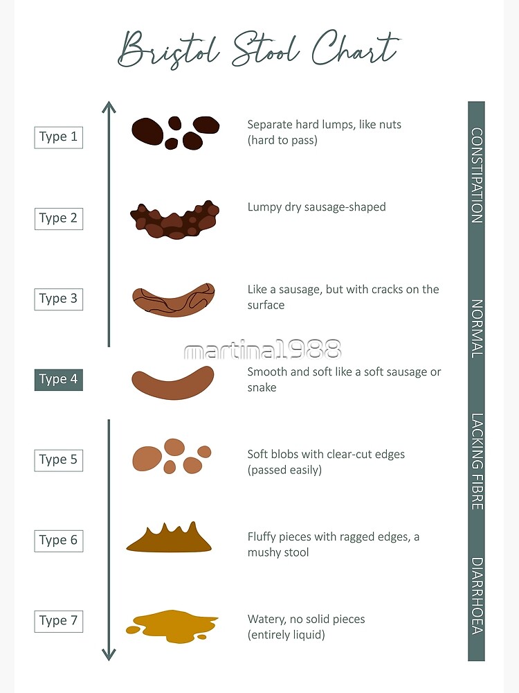 Bristol Stool Chart - Green Premium Matte Vertical Poster sold by Carla ...