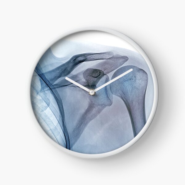 Item preview, Shoulder joint, X-ray (C040/3239) designed and sold by SciencePhoto.