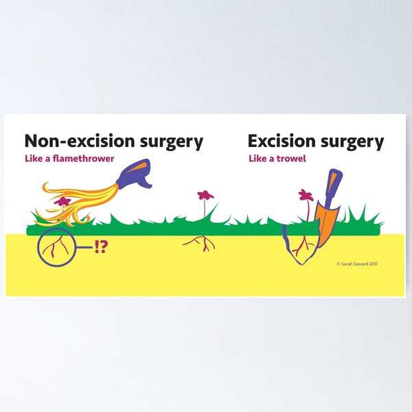 The Endo-Graphic, Excision vs Ablation, Trowel vs Flamethrower Poster