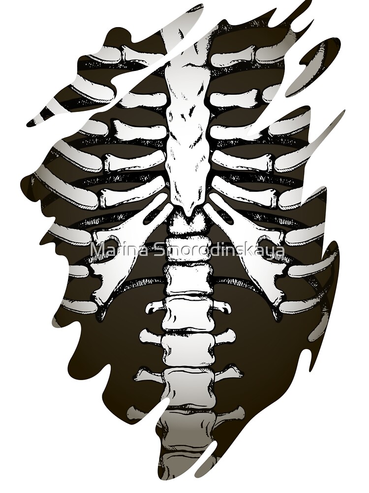 Torn hole with skeleton inside.