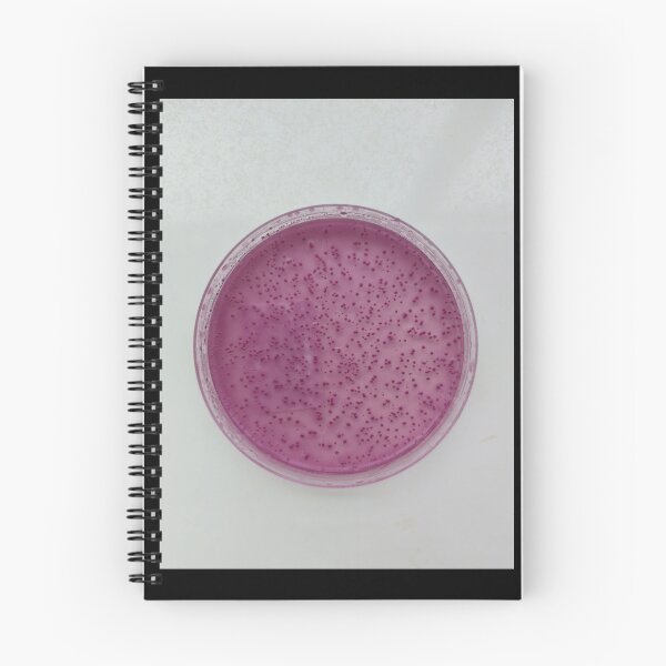Item preview, Enterobacteria colonies on VRBGA designed and sold by Fromthelab.