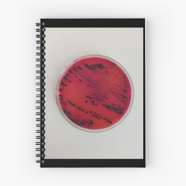 Item preview, Salmonella on XLD designed and sold by Fromthelab.