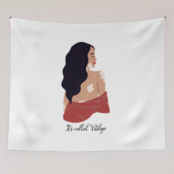 Item preview, STI CALLED VITILIGO designed and sold by Marielc19.