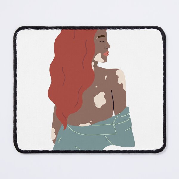 Item preview, Vitiligo Mermaid designed and sold by Marielc19.
