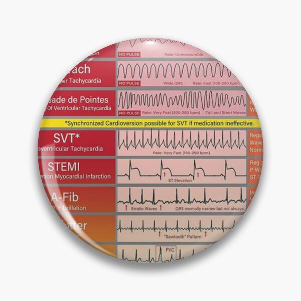 Item preview, Ecg Ekg basics Knowledge  designed and sold by Weird-Artss.