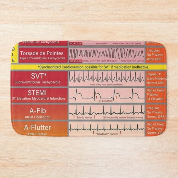 Item preview, Ecg Ekg basics Knowledge  designed and sold by Weird-Artss.