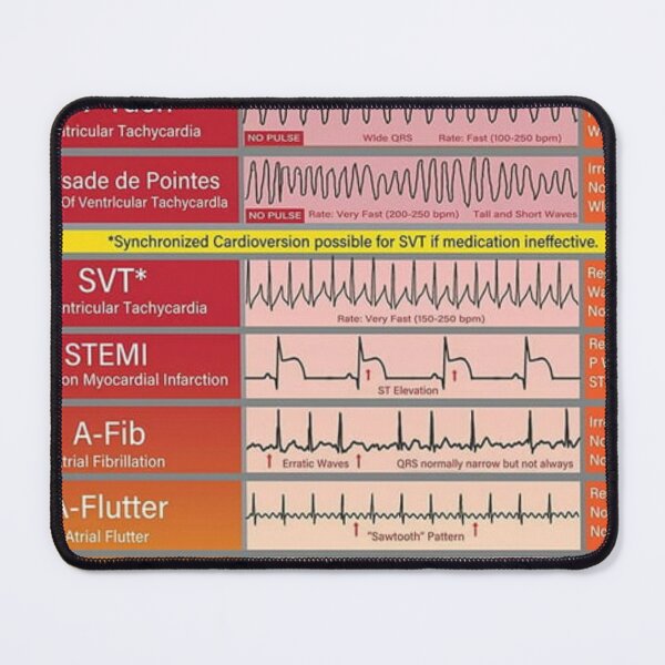 Item preview, Ecg Ekg basics Knowledge  designed and sold by Weird-Artss.