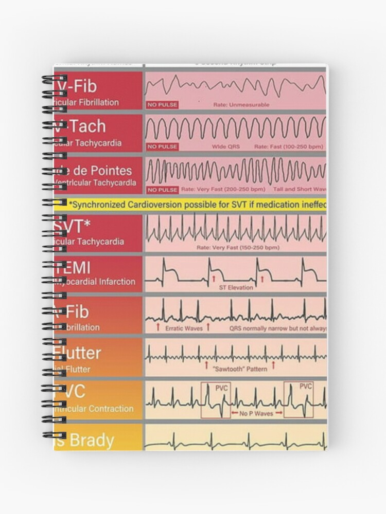 ecg-ekg-basics-knowledge-journal-for-sale-by-weird-artss-redbubble