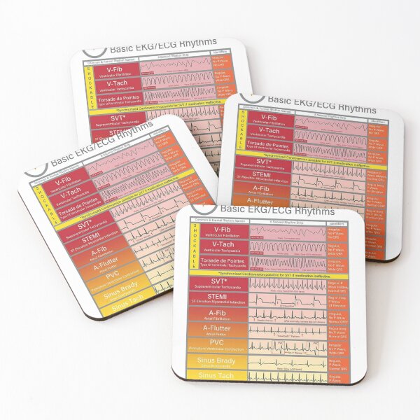 Item preview, Ecg Ekg basics Knowledge  designed and sold by Weird-Artss.