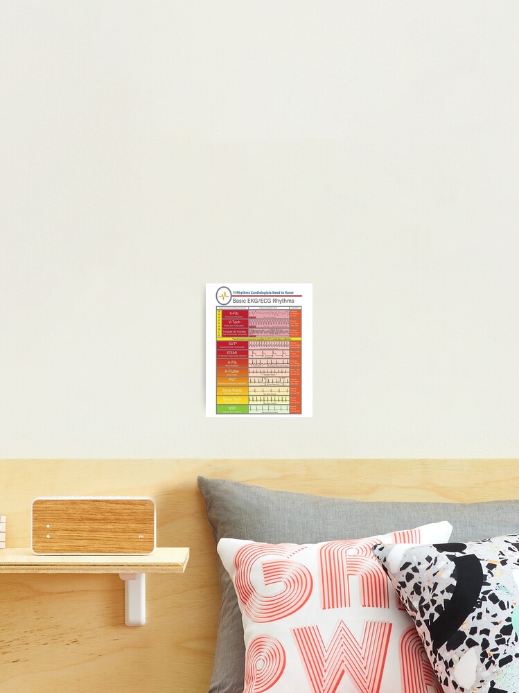 Ecg Ekg basics Knowledge  | Journal